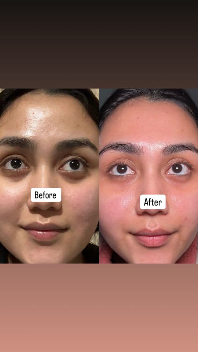 BEAUTY OF JOSEON Revive Eye Serum Ginseng + Retinal review photo by Sandhya