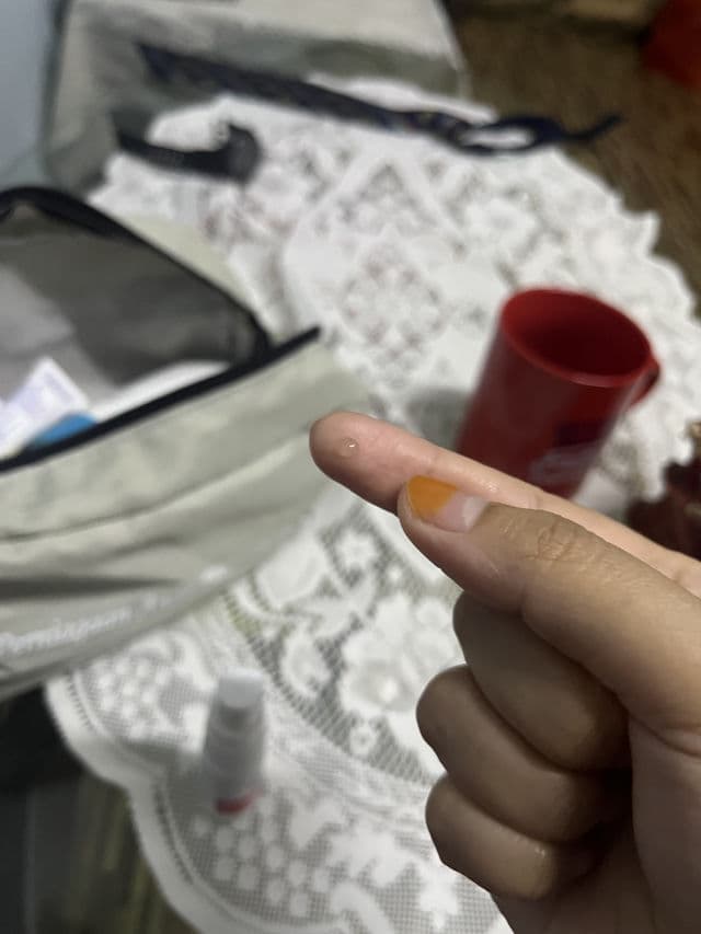 T3 Pimple Gel Plus review photo by Izzy88