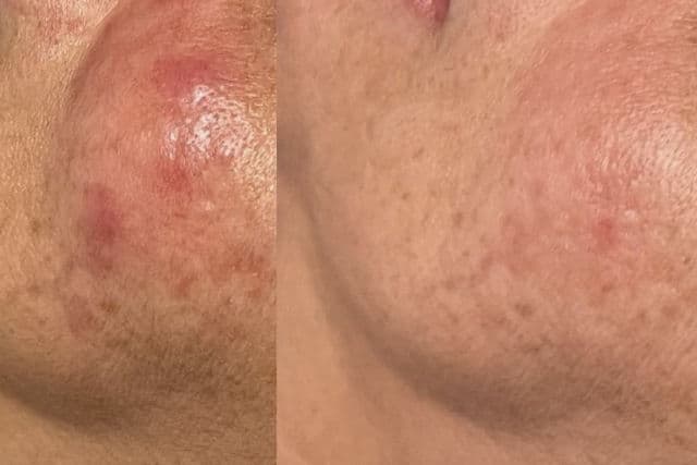 Cosmedix Pure C review photo by sarosifanni1126