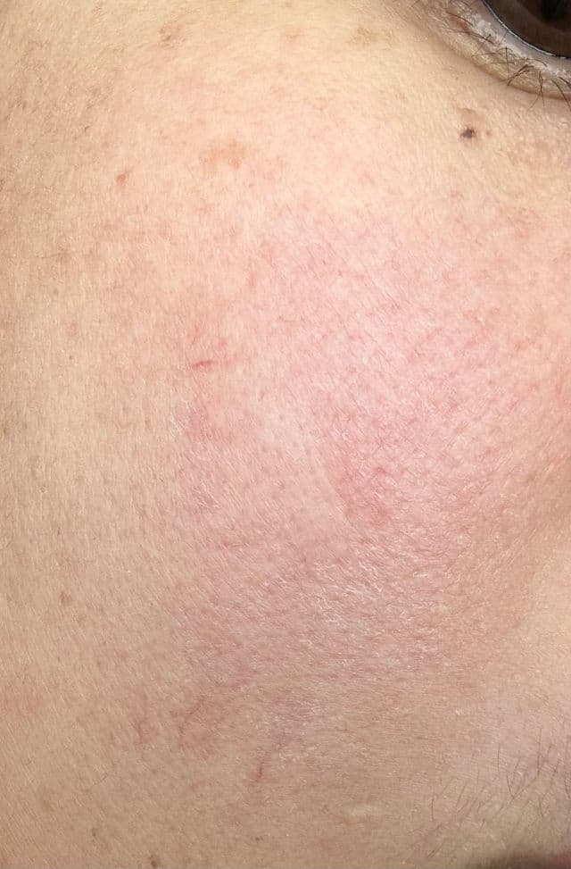 beesline 4 in 1 Whitening Cleanser review photo by thatasnd2k