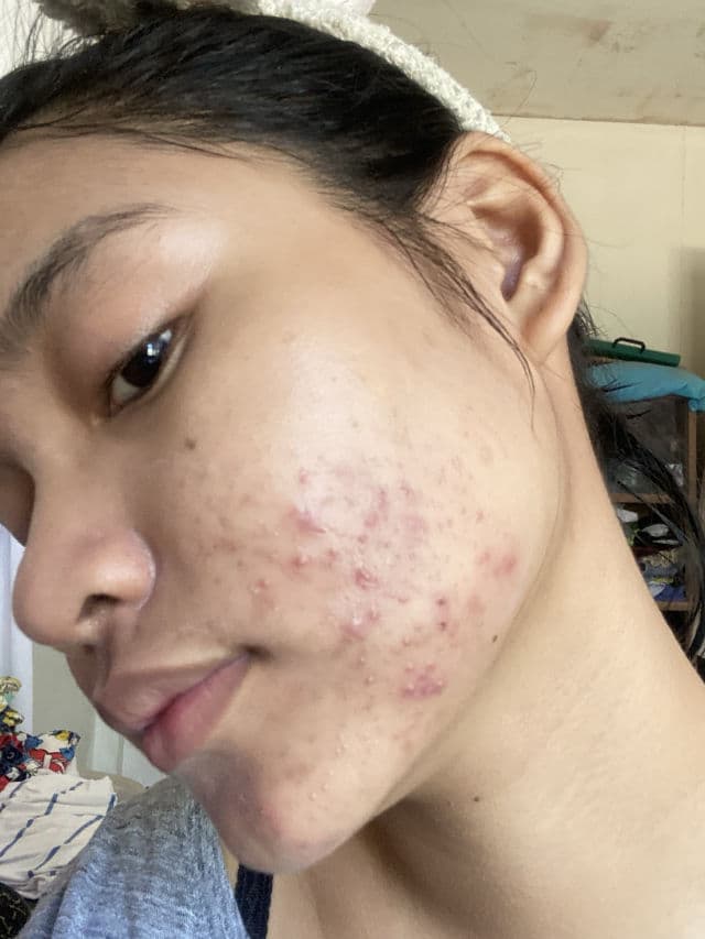 The Originote Mugwort B3 Clay Stick Mask review photo by AngelPedralvez