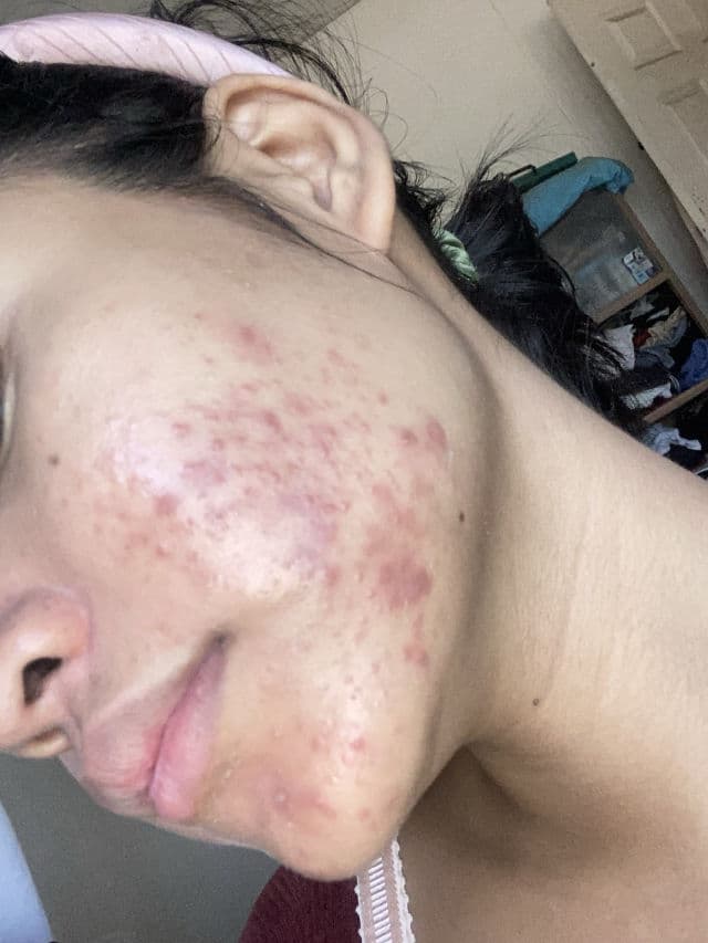 The Originote Mugwort B3 Clay Stick Mask review photo by AngelPedralvez