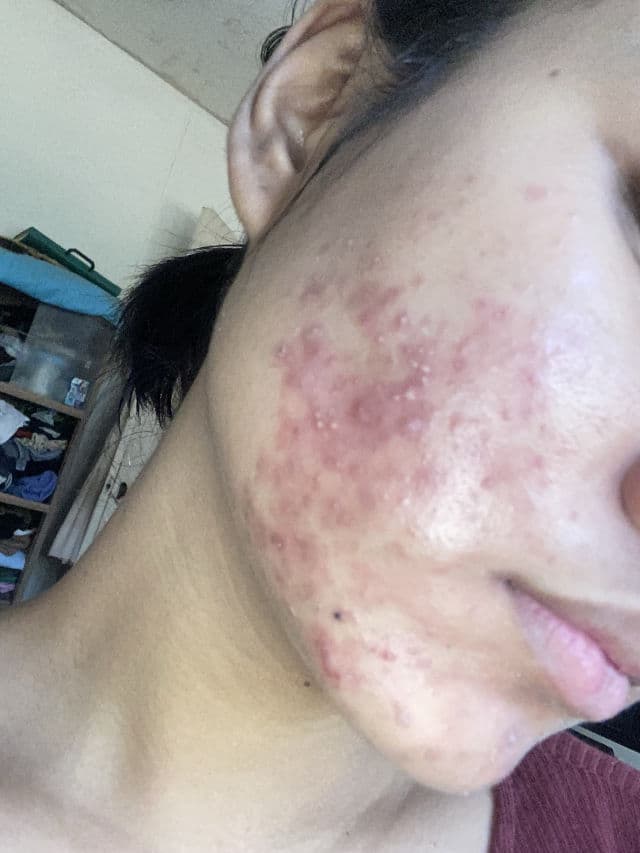 The Originote Mugwort B3 Clay Stick Mask review photo by AngelPedralvez