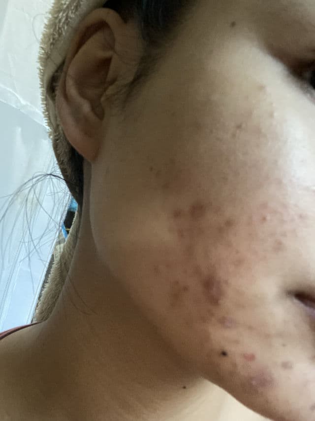 The Originote Mugwort B3 Clay Stick Mask review photo by AngelPedralvez