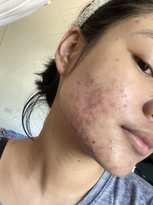 The Originote Mugwort B3 Clay Stick Mask review photo by AngelPedralvez