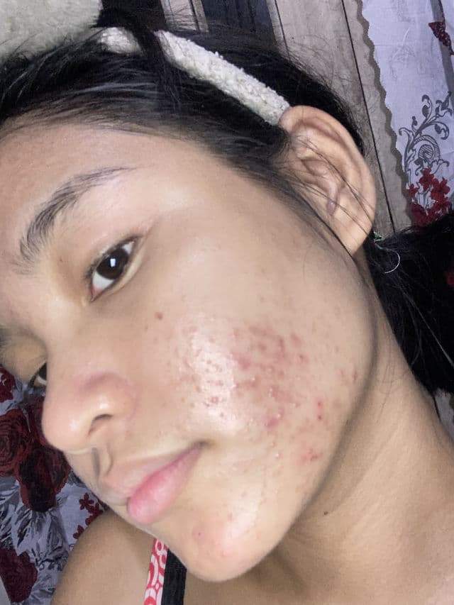 The Originote Mugwort B3 Clay Stick Mask review photo by AngelPedralvez