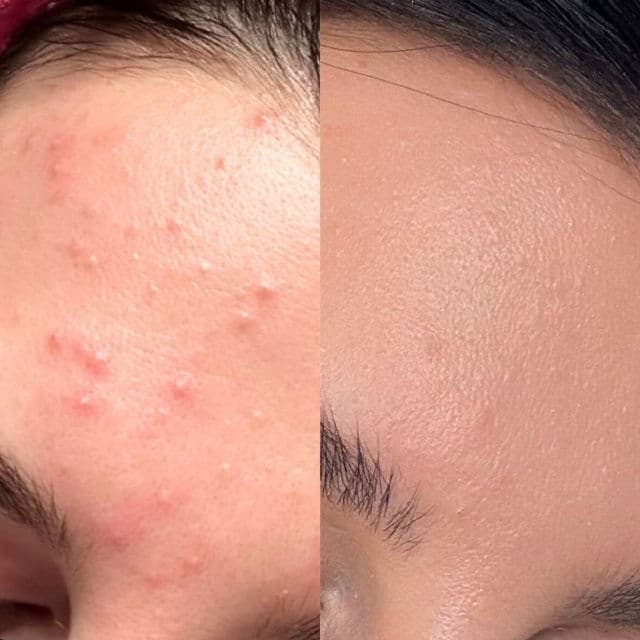 VT COSMETICS Azelaic A1 Calming Ampoule review photo by whoisirina