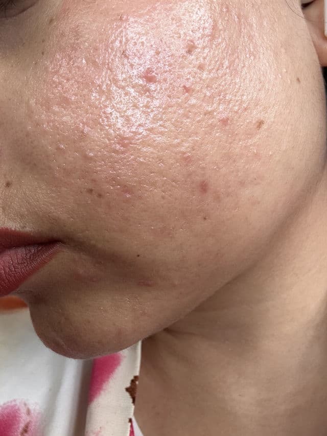 numbuzin No.5 Glutathione Vitamin C Concentrated Serum review photo by NISA