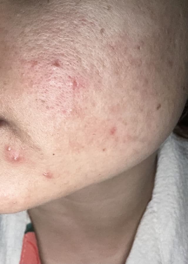 numbuzin No.5 Glutathione Vitamin C Concentrated Serum review photo by NISA