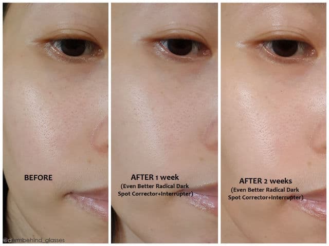 Clinique Even Better Clinical™ Radical Dark Spot Corrector + Interrupter review photo by NikkiGBG