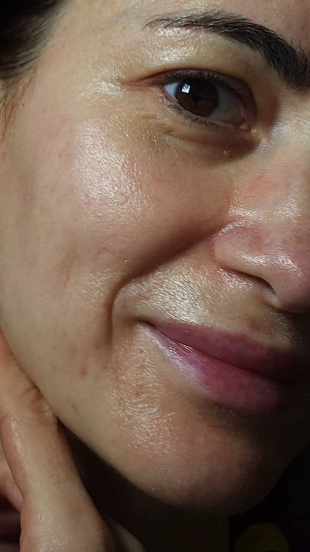 Centellian24 Expert Madeca Cream Active Renew PDRN review photo by Lisolga