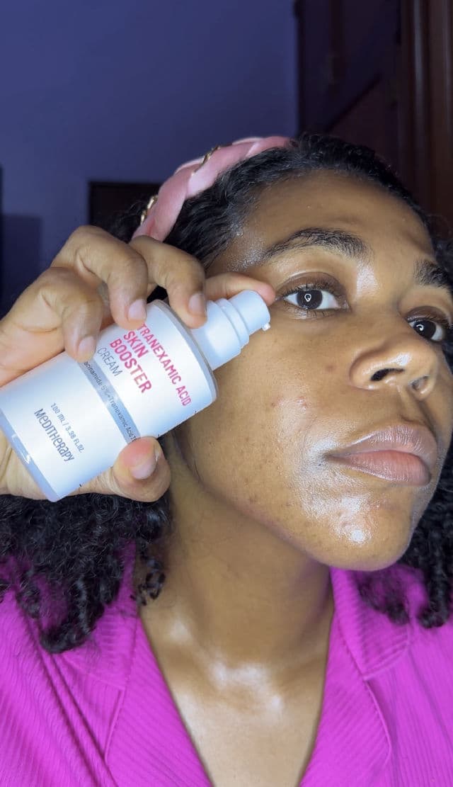 Meditherapy Tranexamic Acid Skin Booster Cream + Device review photo by Rocecil