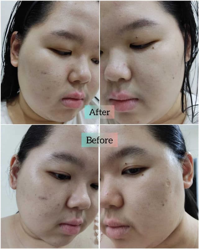 Sanny & Joleen Lifestyle Antioxidant Serum review photo by Muziz