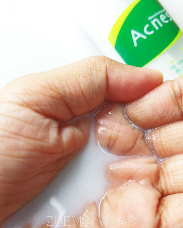 Mentholatum Acnes Powder Lotion review photo by zuemohamad