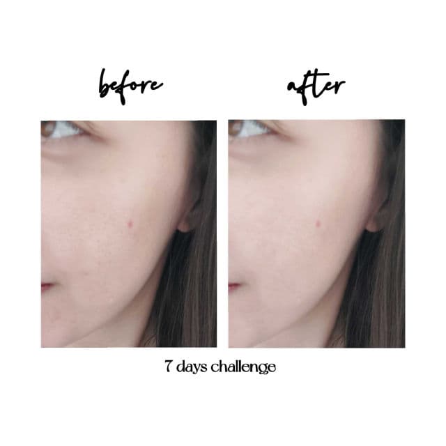 Dr. Wu Intensive Renewal Serum With Mandelic Acid 18% review photo by iamSeira