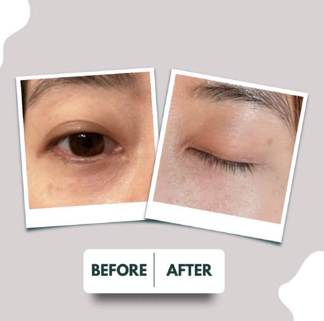 Dr. Loretta Tightening Eye Gel  review photo by esthicatq