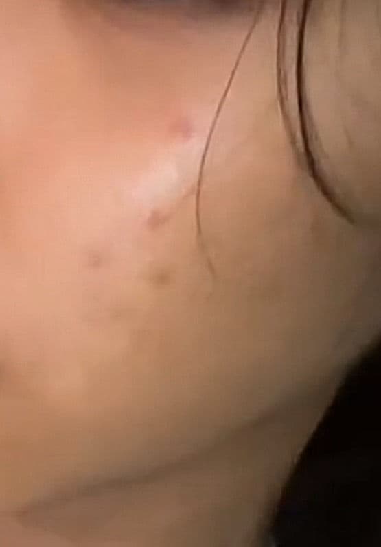 SKIN1004 Madagascar Centella Toning Toner review photo by gisElle