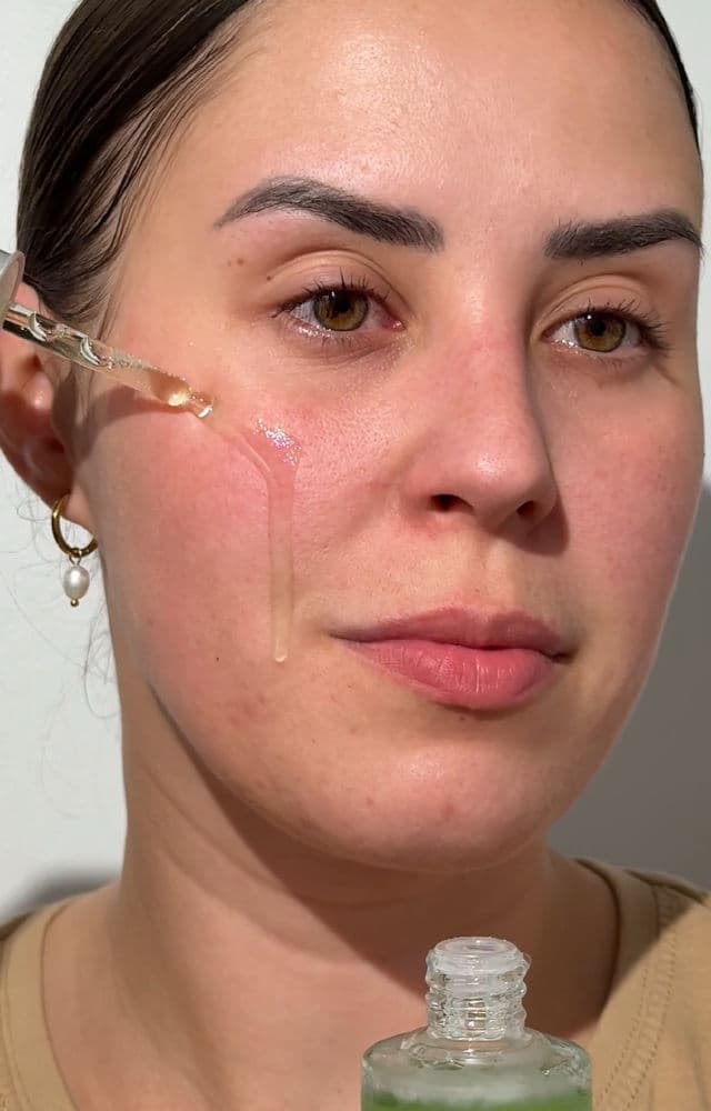 ANUA Azelaic Acid 10 Hyaluron Redness Soothing Serum review photo by hruzdovak