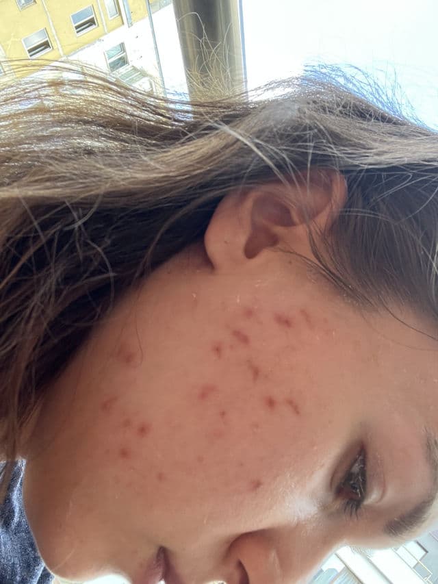 Geek & Gorgeous 101 C-Glow 15% Vitamin C Serum review photo by fani98