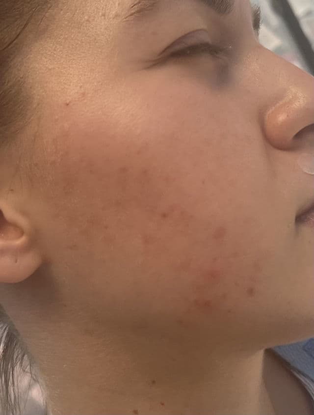 Geek & Gorgeous 101 C-Glow 15% Vitamin C Serum review photo by fani98