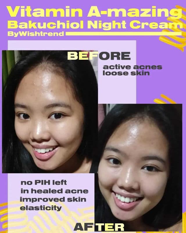 By WISHTREND Vitamin A-mazing Bakuchiol Night Cream review photo by jairahbkc