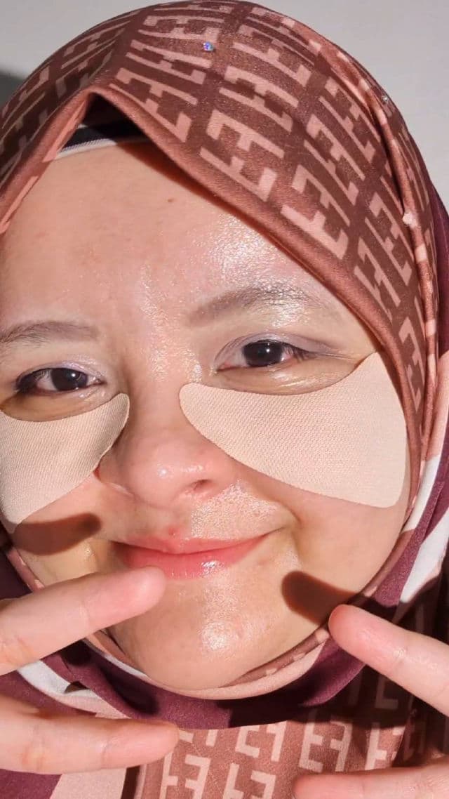 Heimish Watermelon Soothing Sun Patch review photo by ezatulSkincareDiary