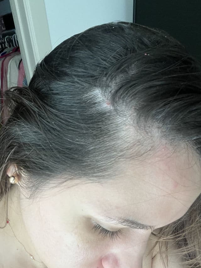 epais Scalp Boosting Ampoule review photo by Anita22