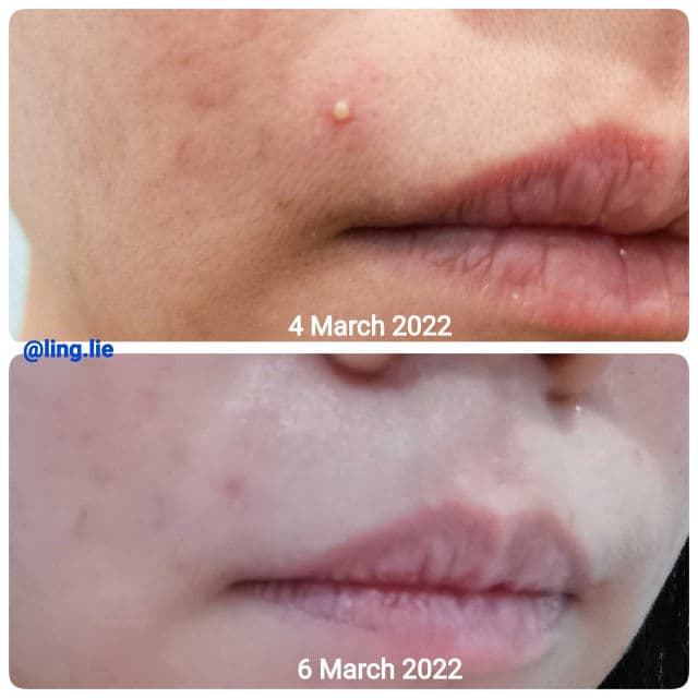 Portia Skin Tamanu Oil review photo by linglee