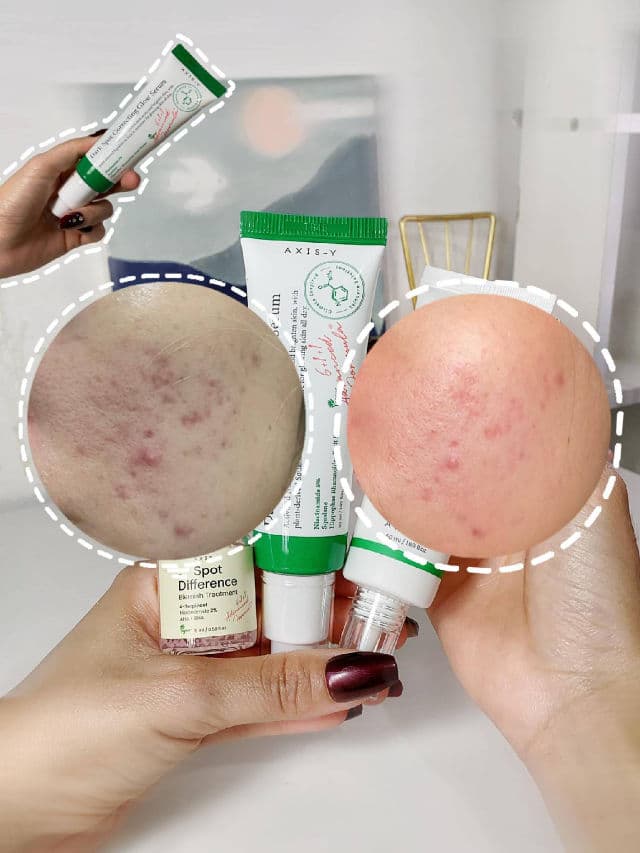 Dark Spot Correcting Glow Serum product review