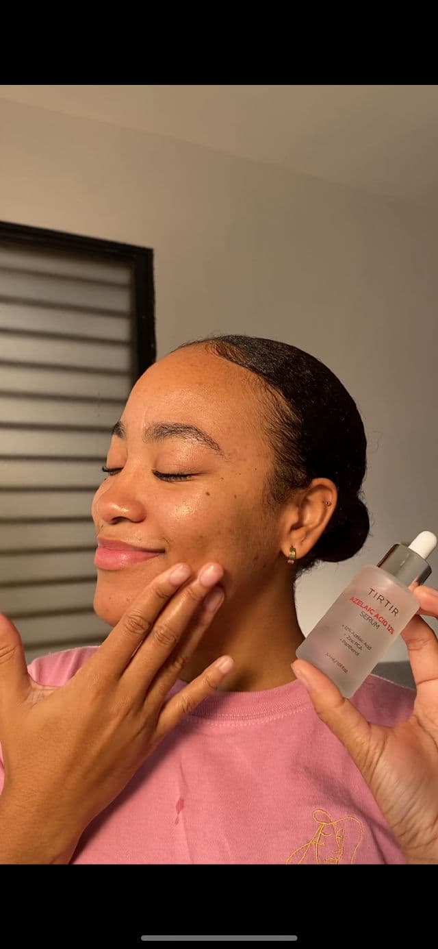 TIRTIR Azelaic Acid 12% Serum review photo by indhirab