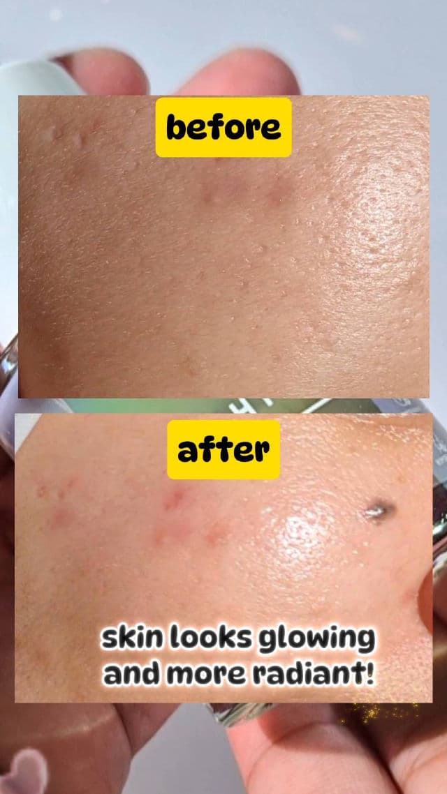 Somethinc Diamond Phyto Stem Cell Serum review photo by ezatulSkincareDiary