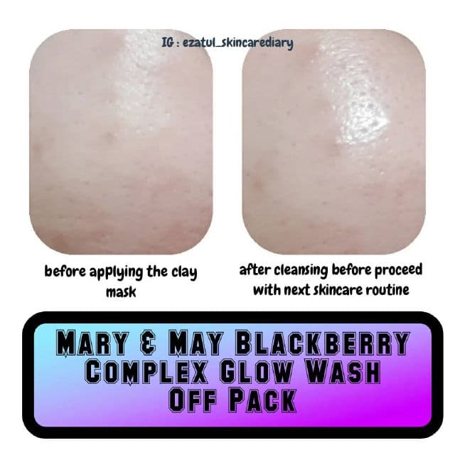 Mary&May Blackberry Complex Glow Wash Off Pack review photo by ezatulSkincareDiary