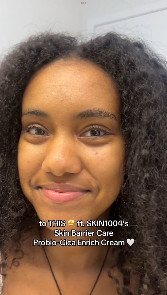 SKIN1004 Madagascar Centella Probio-Cica Enrich Cream review photo by Hiwot