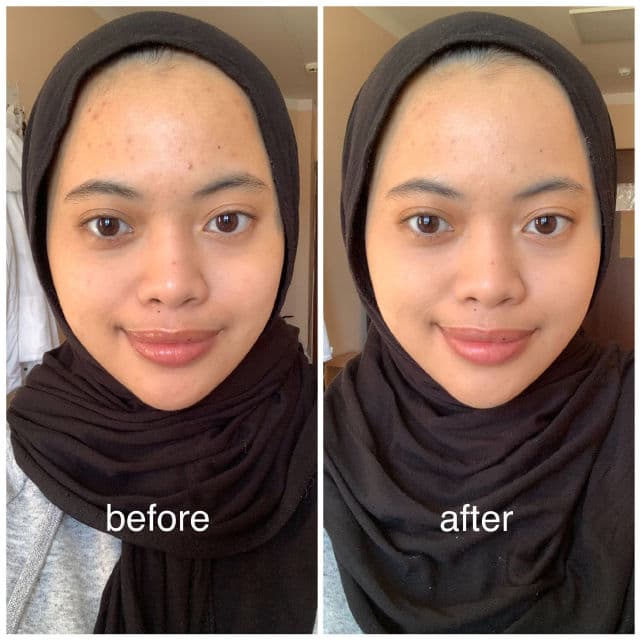 L'Oreal Paris True Match Nude Hyaluronic Tinted Serum review photo by izzaatiaqilah
