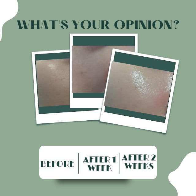 BENTON Snail Bee Ultimate Toner review photo by deby