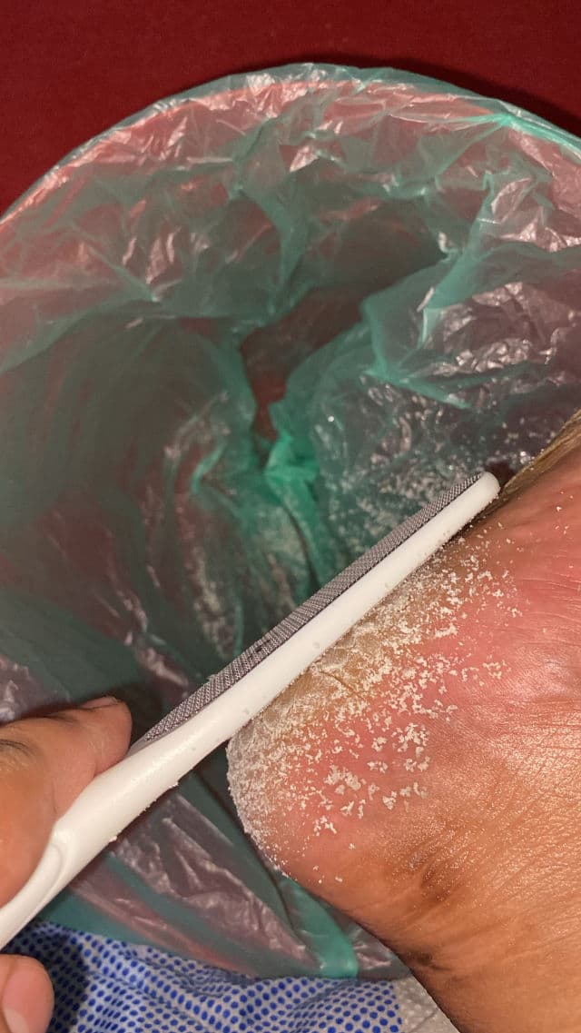 Baren Callus Remover Kit for Feet: Foot File & Peeling Foot Spray review photo by Bazz