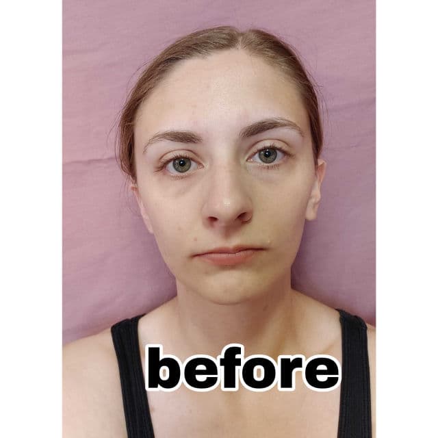 Veracity Selfcare Inflammation Response review photo by shannbit