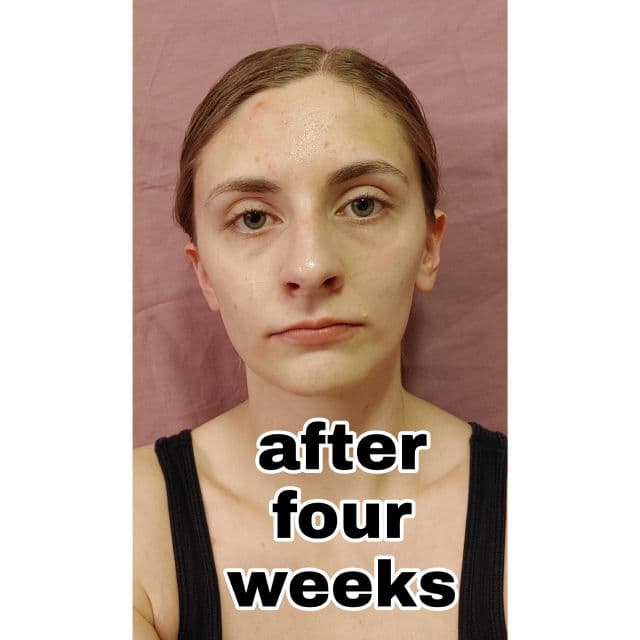 Veracity Selfcare Inflammation Response review photo by shannbit