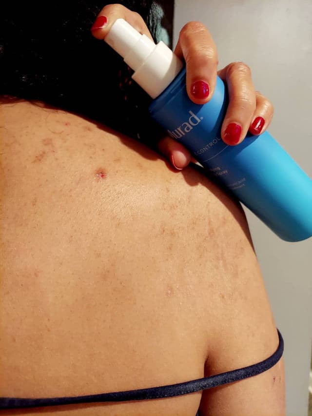 Murad Acne Control Clarifying Body Spray review photo by Deedee1