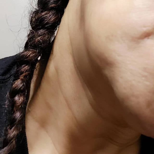 OOTD BEAUTY Wrinkle Lift Retinol Serum review photo by Deedee1