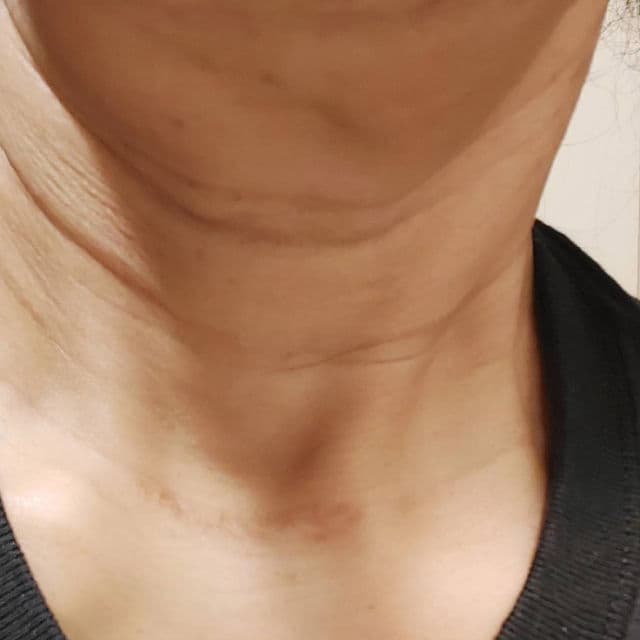 OOTD BEAUTY Wrinkle Lift Retinol Serum review photo by Deedee1