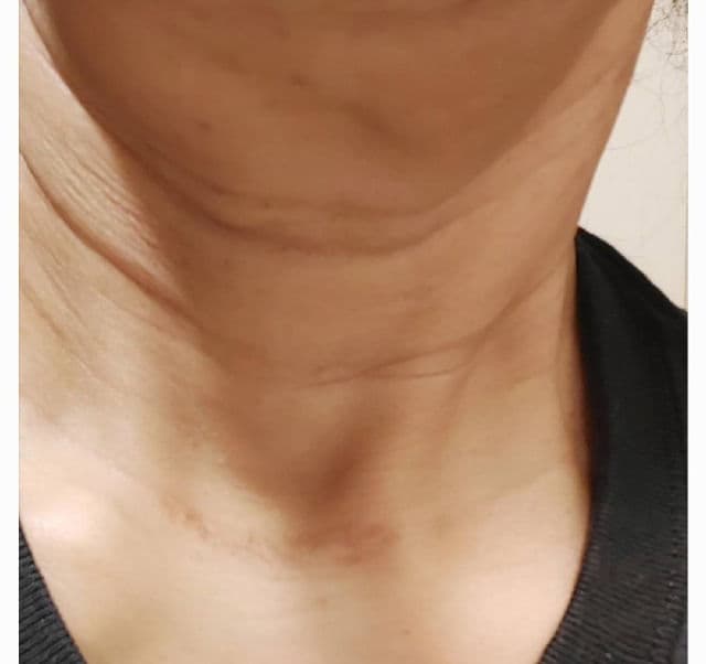 BIOHEAL BOH Probioderm Lifting Cream review photo by Deedee1