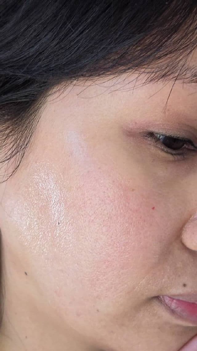 Centellian24 Madeca Cream Time Reverse review photo by willworkformascara