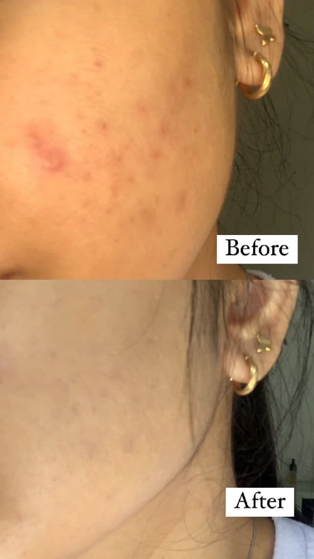 L'Oreal Paris Infallible 24h More Than Concealer review photo by angegege