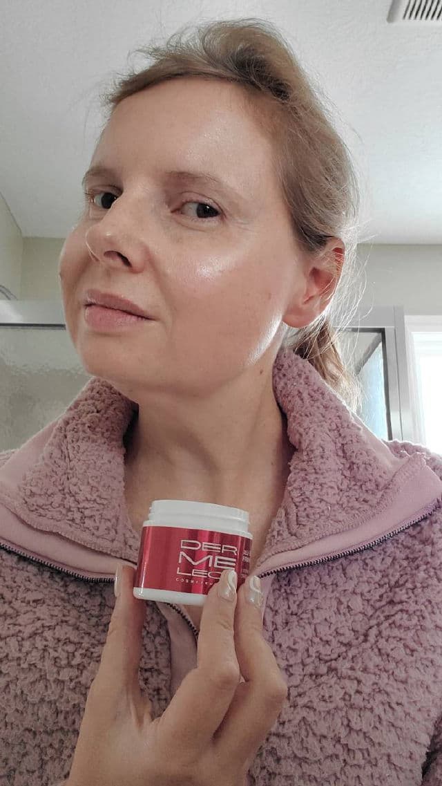 Dermelect Self-Esteem Neck Firming Lift review photo by Hendrika01