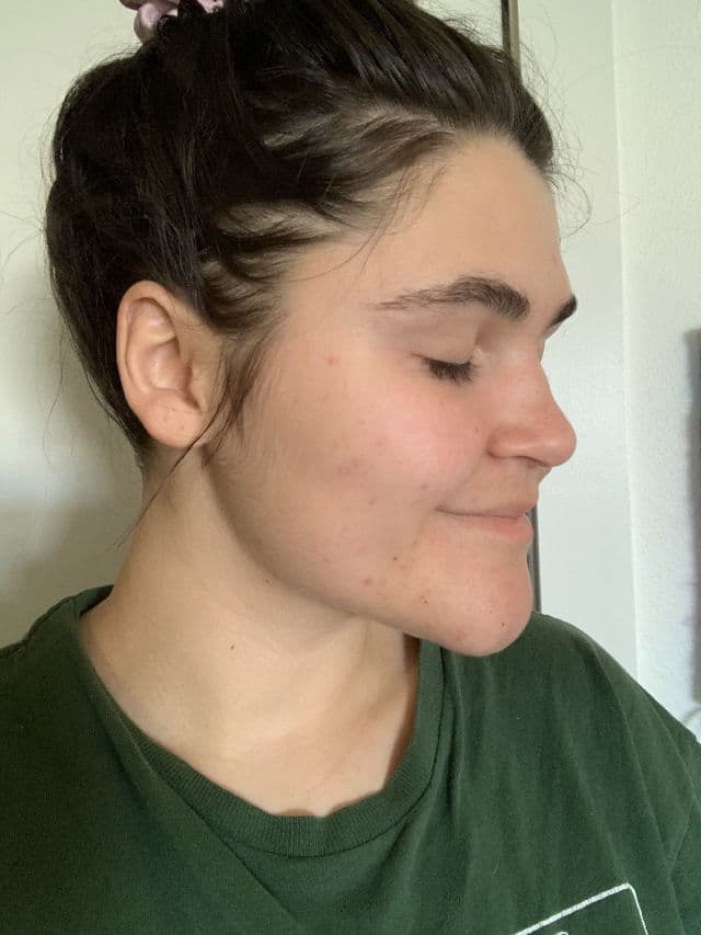 Hero Cosmetics Rescue Balm +Red Correct review photo by happygalselfcare