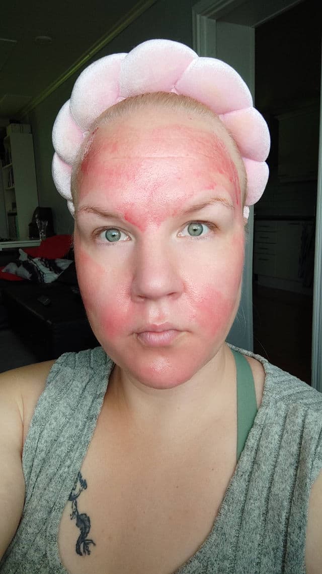 COSRX The AHA BHA PHA LHA 35 Peel review photo by beauty101finland