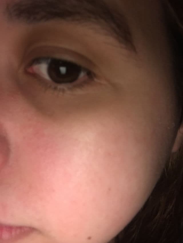 Alpyn Beauty Plantgenius Line-Filling Eye Balm review photo by kb24