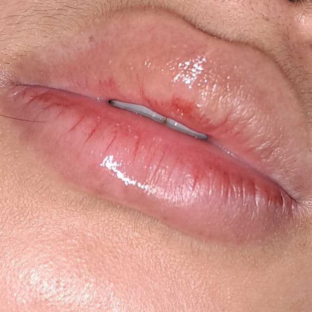 Noera by Reisha Vita Lip Serum review photo by auliaasaf