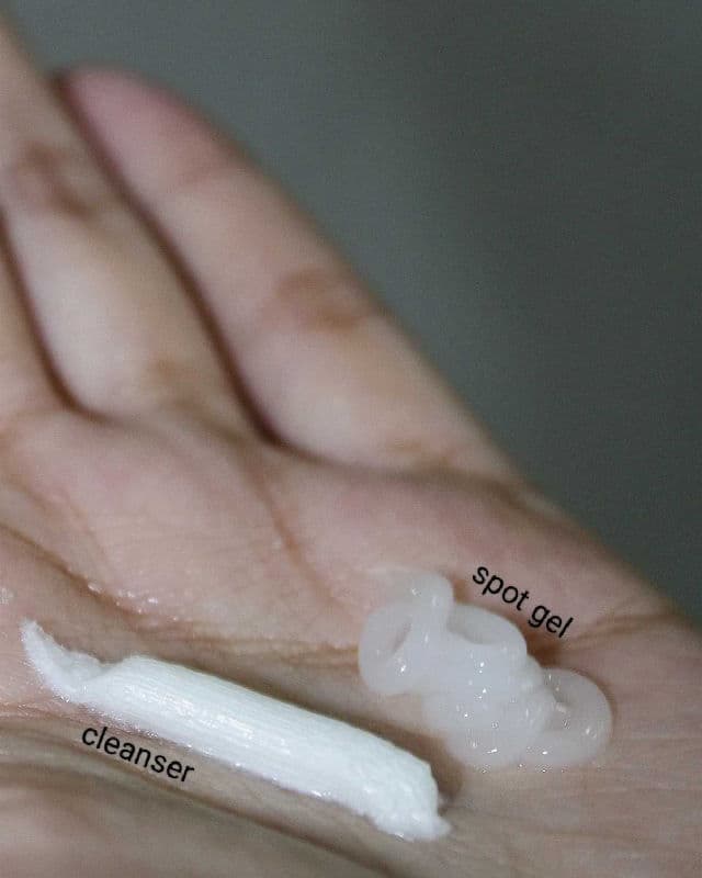 Troubless Spot Gel review photo by skeengeeks